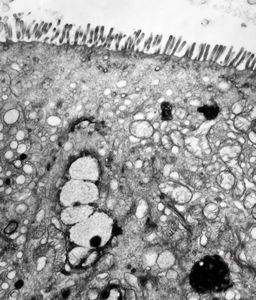 celiakia celiakia
